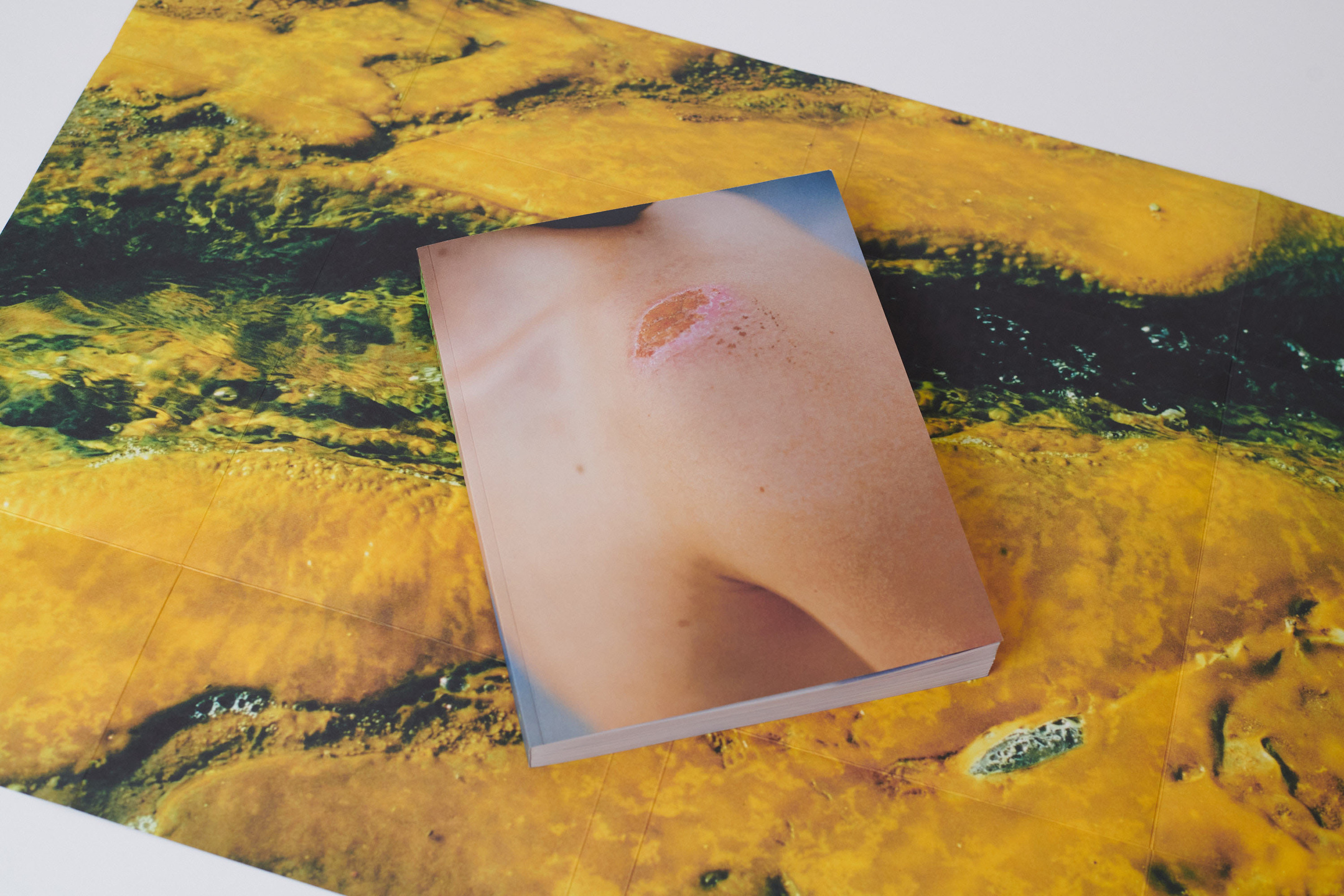 Bumps Book & Exhibition